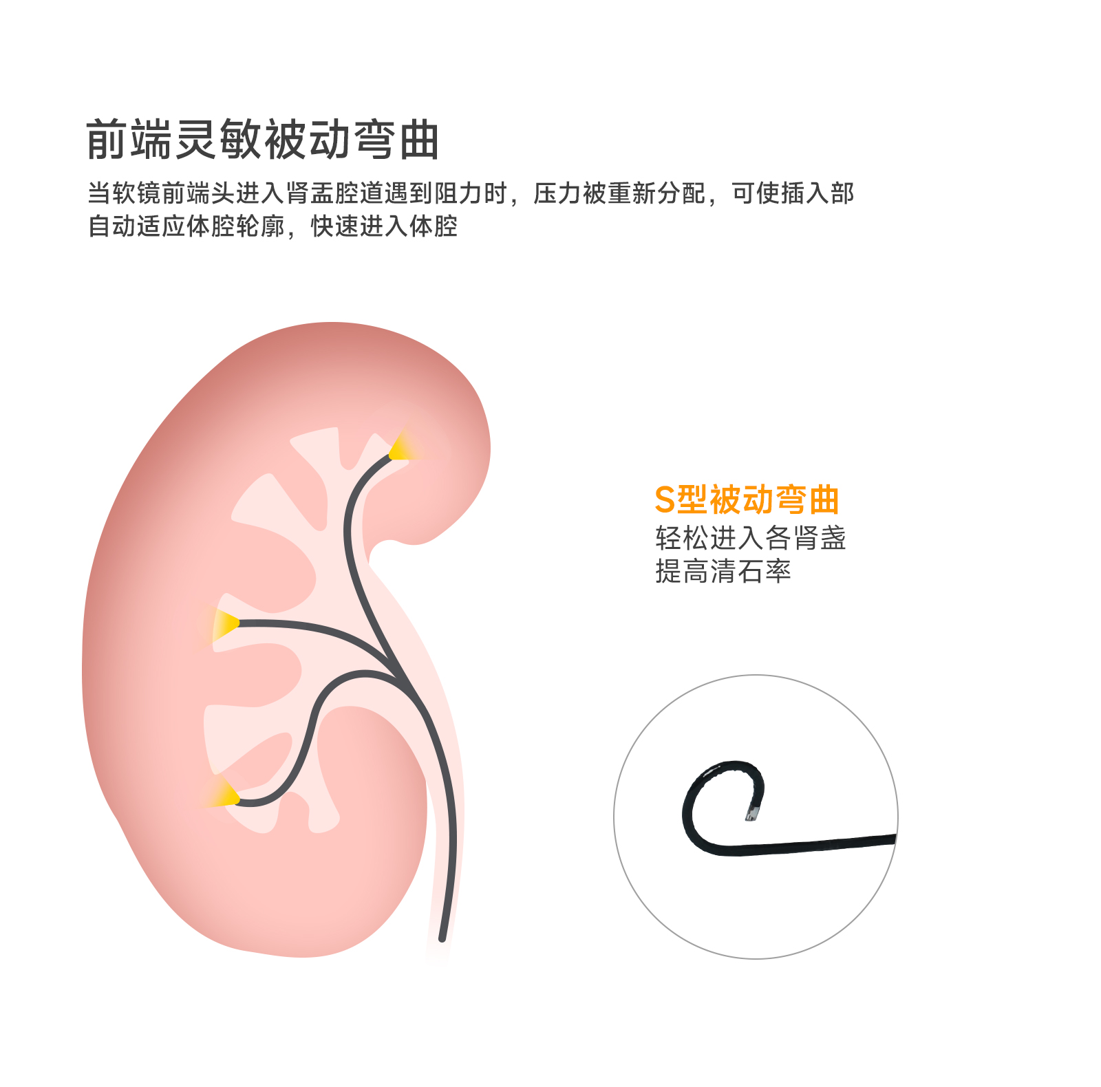 一次性泌尿镜详情页_06.jpg